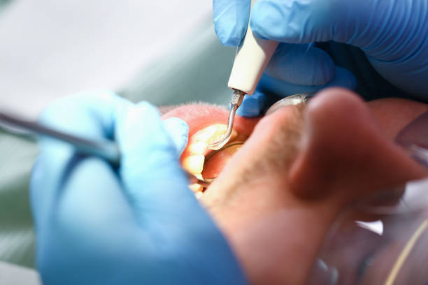 Best Chipped Tooth Repair Near Me  in Wilmington Manor, DE