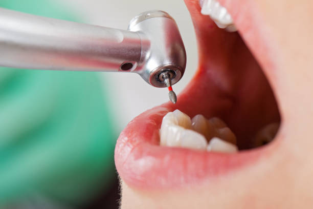 Best Broken Tooth Emergency  in Wilmington Manor, DE